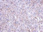 CRHR1 Antibody in Immunohistochemistry (Paraffin) (IHC (P))