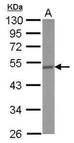 CRHR1 Antibody in Western Blot (WB)