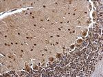 BCL7A Antibody in Immunohistochemistry (Paraffin) (IHC (P))