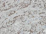 BCL7A Antibody in Immunohistochemistry (Paraffin) (IHC (P))