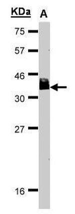 BCL7A Antibody in Western Blot (WB)