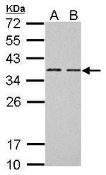 BCL7A Antibody in Western Blot (WB)