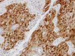 DDX5 Antibody in Immunohistochemistry (Paraffin) (IHC (P))