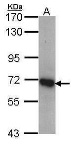 DDX5 Antibody in Western Blot (WB)