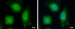 RCAN1 Antibody in Immunocytochemistry (ICC/IF)