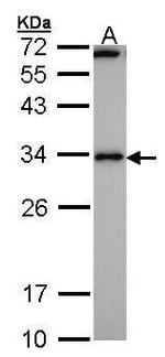 RCAN1 Antibody in Western Blot (WB)