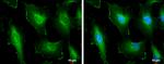 Cortactin Antibody in Immunocytochemistry (ICC/IF)