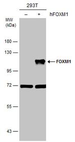 FOXM1 Antibody in Western Blot (WB)