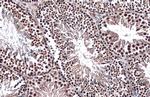 FOXO3A Antibody in Immunohistochemistry (Paraffin) (IHC (P))