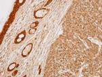 14-3-3 sigma Antibody in Immunohistochemistry (Paraffin) (IHC (P))