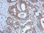 GPX2 Antibody in Immunohistochemistry (Paraffin) (IHC (P))