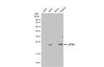 GPX2 Antibody in Western Blot (WB)