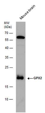 GPX2 Antibody in Western Blot (WB)