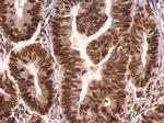 GRB2 Antibody in Immunohistochemistry (Paraffin) (IHC (P))