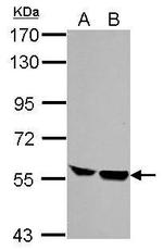 HCLS1 Antibody in Western Blot (WB)