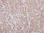 ADAMTS5 Antibody in Immunohistochemistry (Paraffin) (IHC (P))