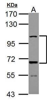 ADAMTS5 Antibody in Western Blot (WB)