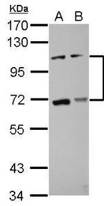 ADAMTS5 Antibody in Western Blot (WB)