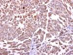 CCKBR Antibody in Immunohistochemistry (Paraffin) (IHC (P))