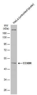 CCKBR Antibody in Western Blot (WB)