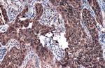 RAD51 Antibody in Immunohistochemistry (Paraffin) (IHC (P))