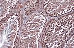 RAD51 Antibody in Immunohistochemistry (Paraffin) (IHC (P))