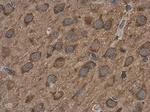 ABAT Antibody in Immunohistochemistry (Paraffin) (IHC (P))