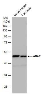 ABAT Antibody in Western Blot (WB)