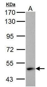 ABAT Antibody in Western Blot (WB)