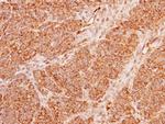 ACADM Antibody in Immunohistochemistry (Paraffin) (IHC (P))