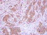 XIAP Antibody in Immunohistochemistry (Paraffin) (IHC (P))