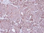 XIAP Antibody in Immunohistochemistry (Paraffin) (IHC (P))