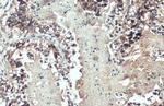 MMP1 Antibody in Immunohistochemistry (Paraffin) (IHC (P))