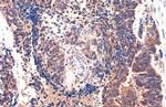 MMP1 Antibody in Immunohistochemistry (Paraffin) (IHC (P))