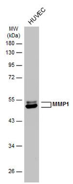 MMP1 Antibody in Western Blot (WB)