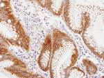 MVP Antibody in Immunohistochemistry (Paraffin) (IHC (P))