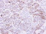 NDRG1 Antibody in Immunohistochemistry (Paraffin) (IHC (P))