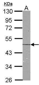 NDRG1 Antibody in Western Blot (WB)