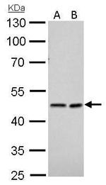 NDRG1 Antibody in Western Blot (WB)