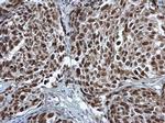 PCNA Antibody in Immunohistochemistry (Paraffin) (IHC (P))