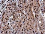 PARP1 Antibody in Immunohistochemistry (Paraffin) (IHC (P))