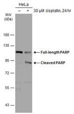 PARP1 Antibody in Western Blot (WB)