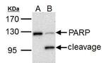 PARP1 Antibody in Western Blot (WB)