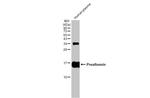 Transthyretin Antibody in Western Blot (WB)