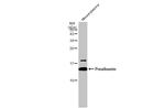 Transthyretin Antibody in Western Blot (WB)