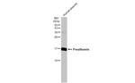 Transthyretin Antibody in Western Blot (WB)