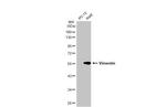 Vimentin Antibody in Western Blot (WB)