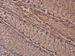 Vimentin Antibody in Immunohistochemistry (Paraffin) (IHC (P))