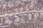 Vimentin Antibody in Immunohistochemistry (Paraffin) (IHC (P))