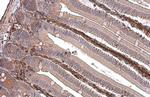 Vimentin Antibody in Immunohistochemistry (Paraffin) (IHC (P))